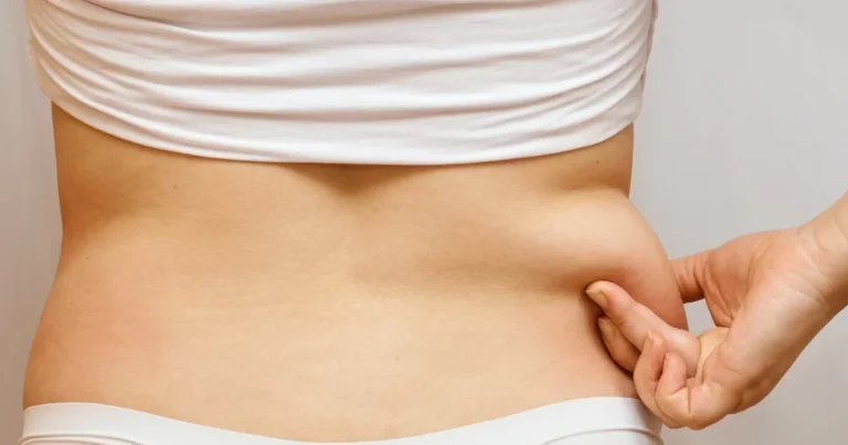 back fat liposuction in korea