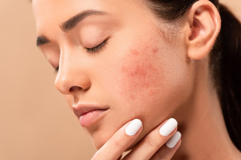 Revolutionize Your Skin: Acne Treatment in Korea